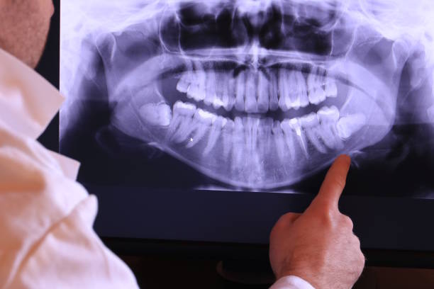 Best Emergency Care for Gum Disease in Alamo, NV