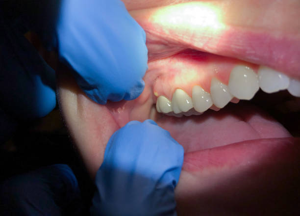 Best Emergency Cosmetic Dentistry (e.g., broken veneers) in Alamo, NV